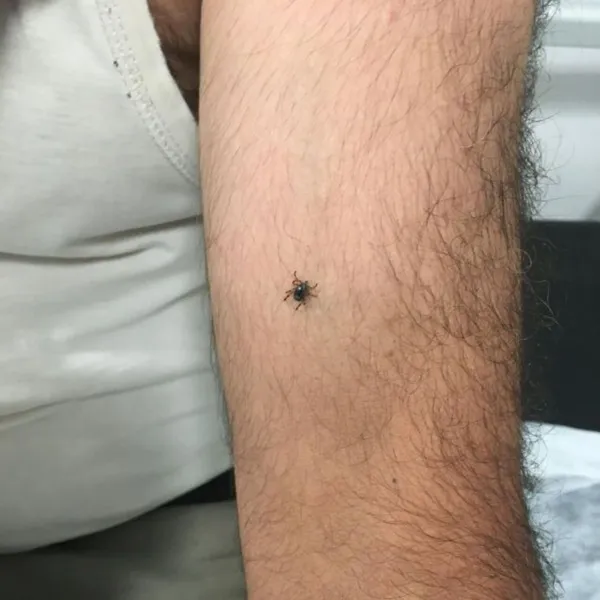 Kayseri'de Kene Alarmı! Yeni Vaka Şoku!