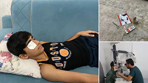 Japon Yapıştırıcısı Kabusu! Gözüne Sıçradı, Mucize Kurtuluş!